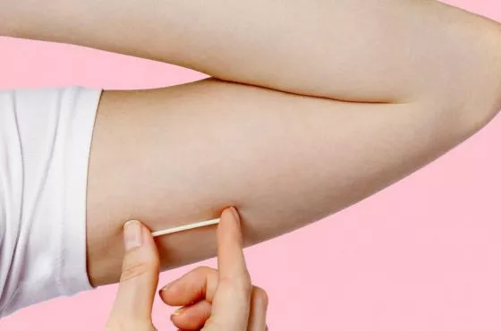89142-colocaran-implantes-subdermicos-anticonceptivos-a-mujeres-de-hasta-19-anios