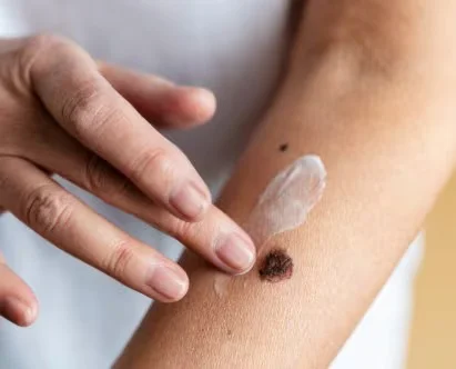 WhatsApp Image 2026-03-17 at 10.59.23