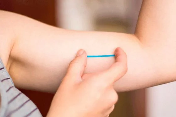 88080-se-colocaran-implantes-subdermicos-en-la-usina-cultural