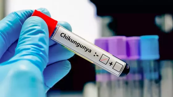 CHIKUNGUNYA-2026