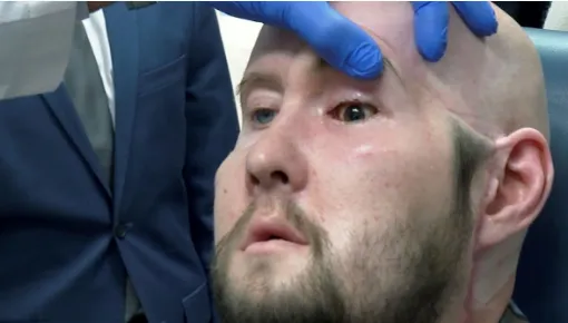 OJO