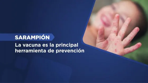 98150-sarampion-la-vacuna-es-principal-herramienta-de-prevencion-20241009152554