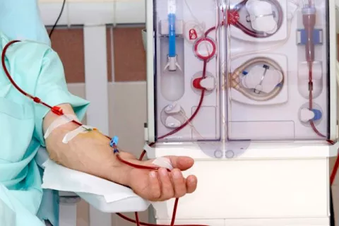 dialisis.jpg