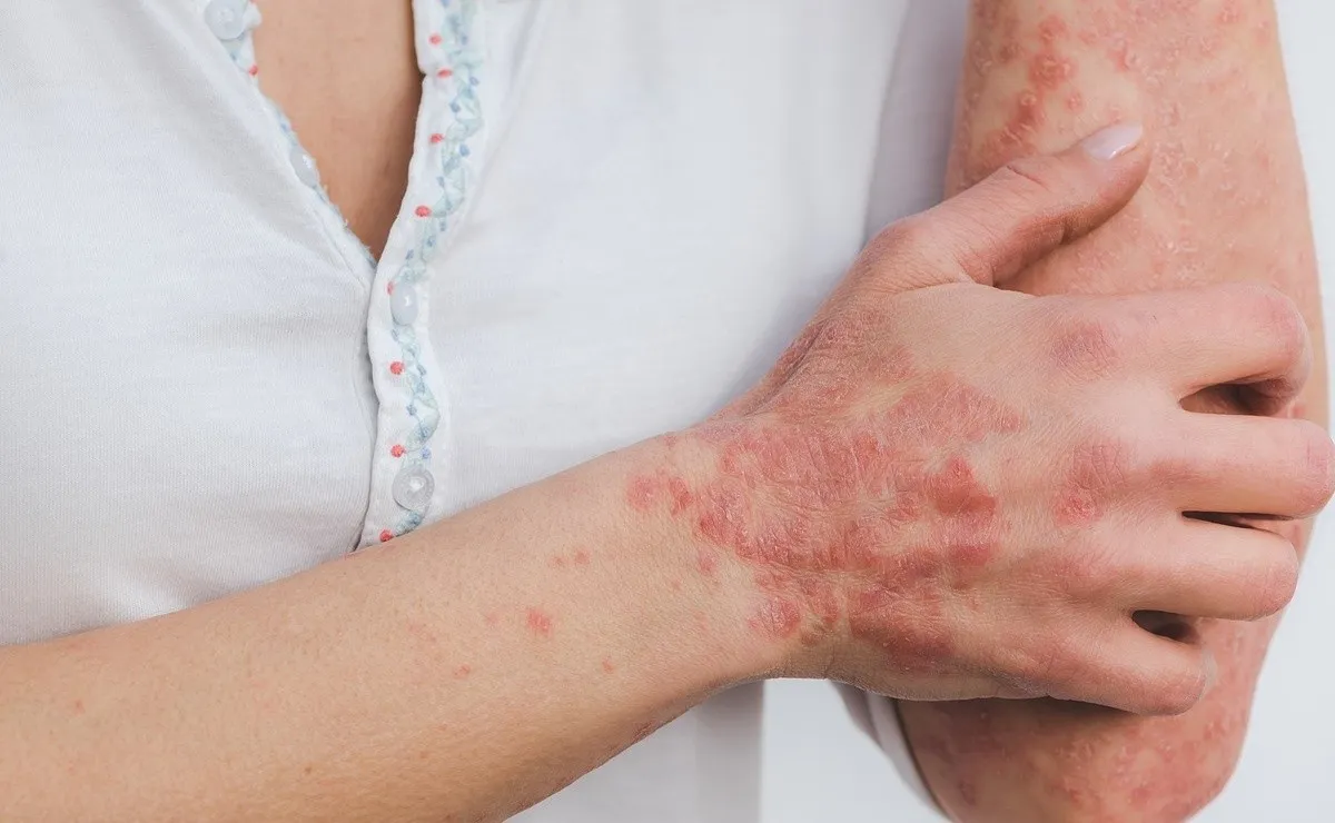 piel_enfermedad.jpg_242310155