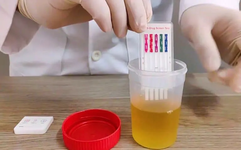 Tipos-de-pruebas-de-antidoping-CEEAD-768x478-1