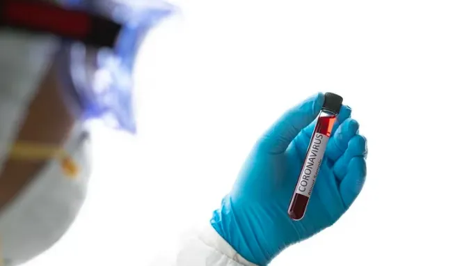 NUEVA CORONAVIRUS