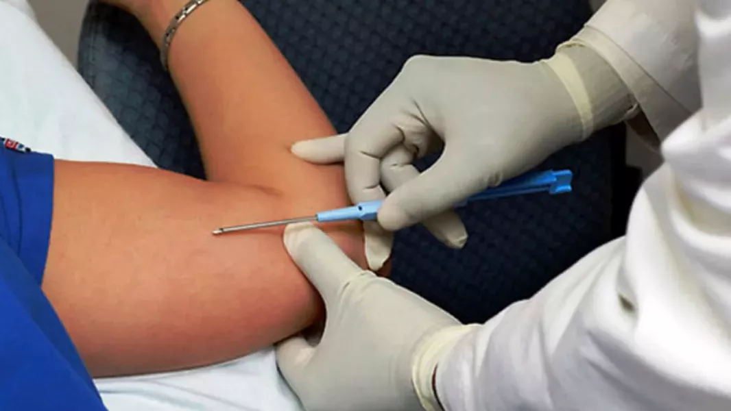 105952-salud-publica-realizara-una-jornada-de-colocacion-de-implantes-subdermicos-en-la-usina-cultural