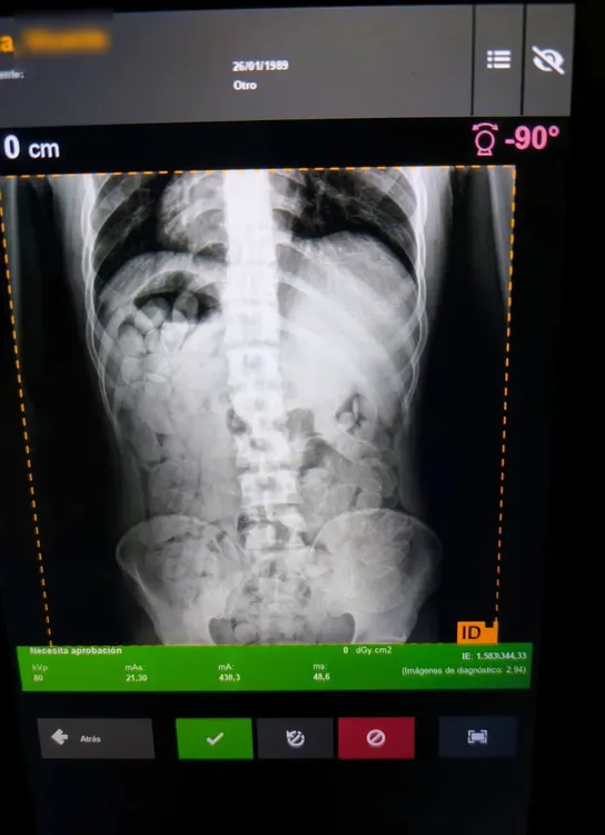 GNA Tucu 4 capsuleros ingerido más de 4 kilos de cocaína 5