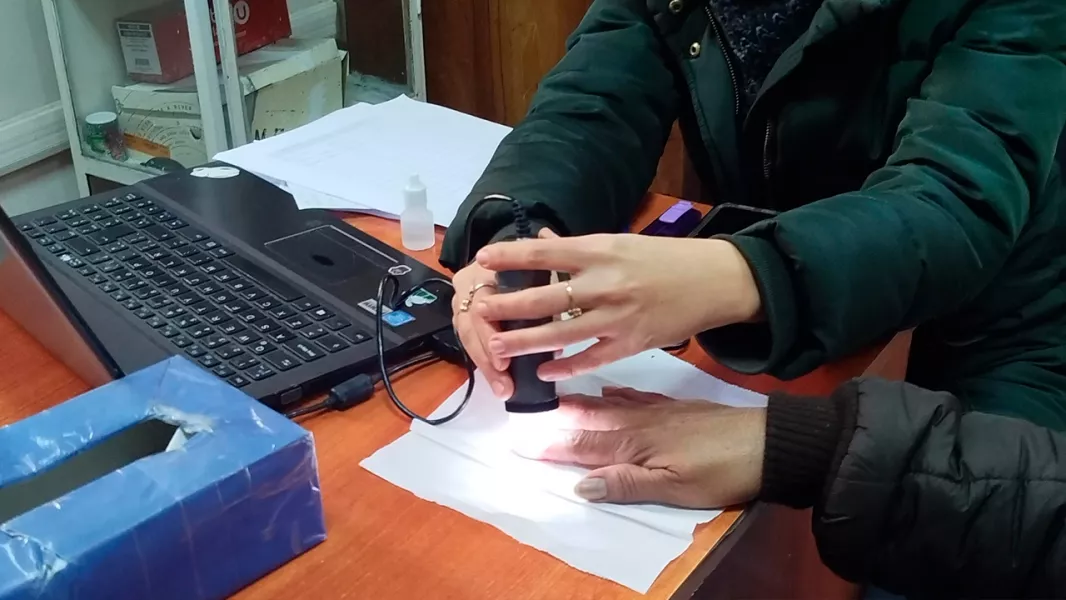18089-en-una-pesquisa-de-esclerodermia-se-detecto-solo-un-caso-positivo (1)
