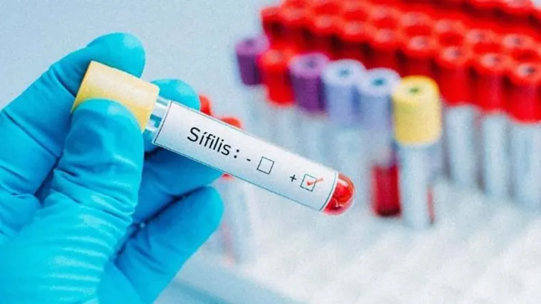 sifilis-png