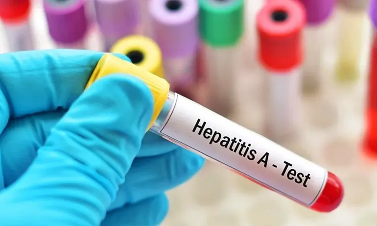 hepatitis-a-test-1