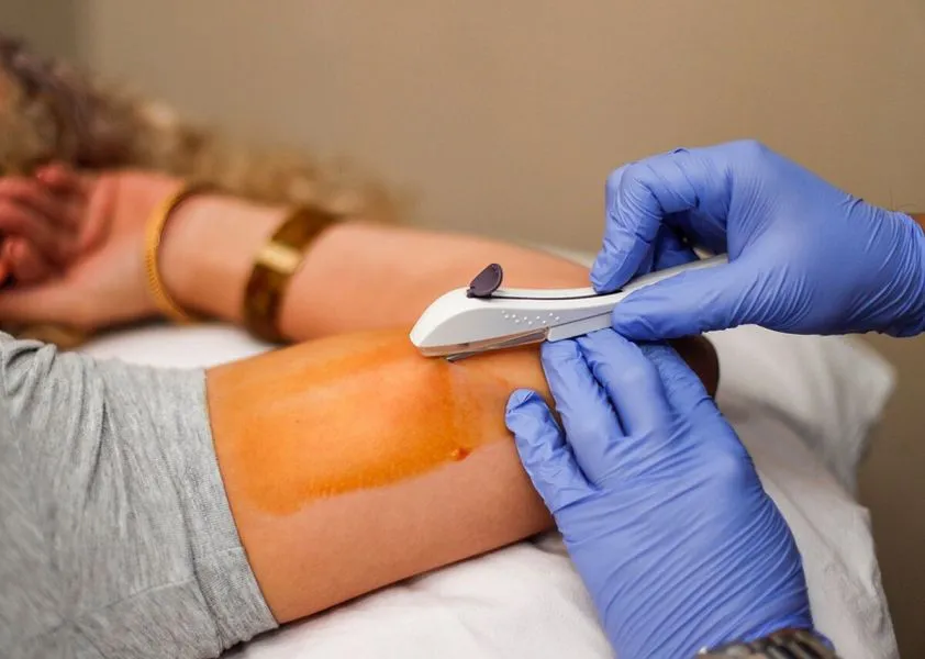 92962-se-colocaran-implantes-anticonceptivos-a-mujeres-de-hasta-19-anios-en-forma-gratuita