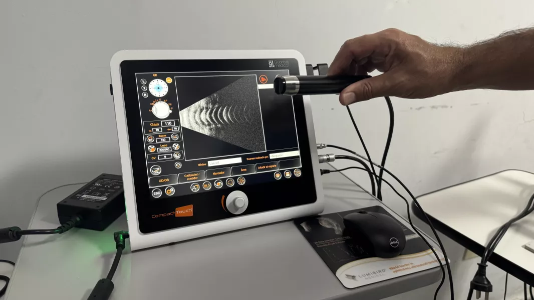 21880-ecografo-ocular-nuevo-en-el-hospital-materno-infantil