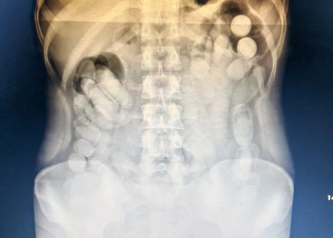 capsulera_detenida-tucuman-118_capsulas-3