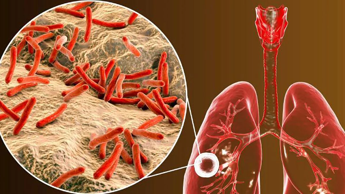 bacilo-tuberculosis.jpg