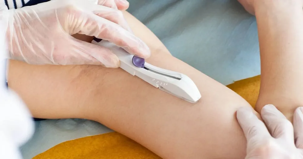 70103-se-colocaron-implantes-subdermicos-anticonceptivos-en-cerrillos