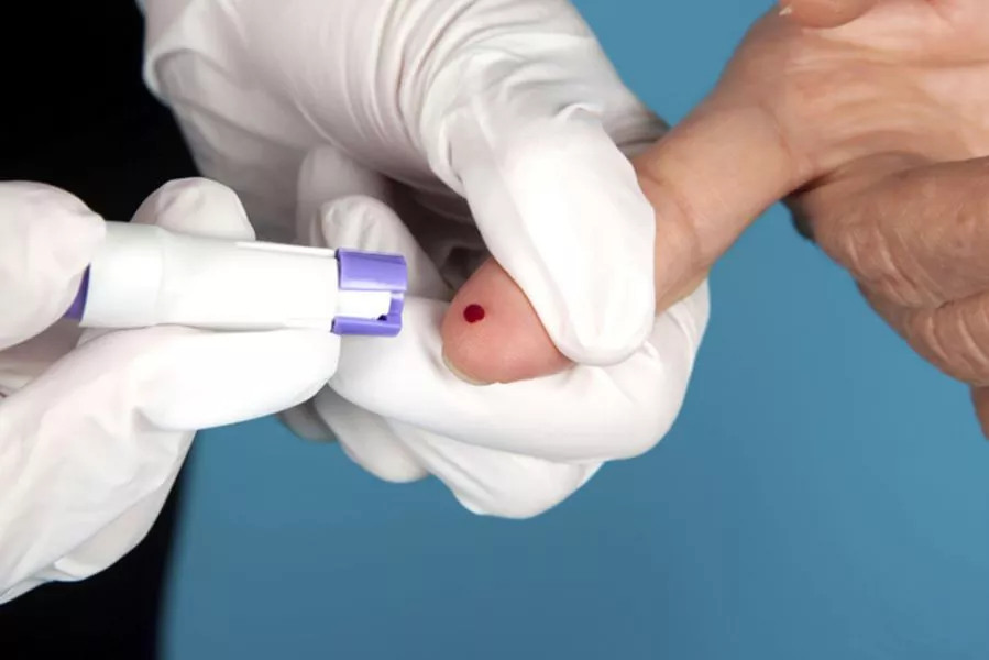 83232-el-test-de-vih-es-la-unica-forma-de-conocer-el-estado-serologico-de-las-personas