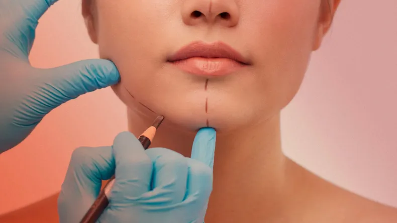 cirugias-esteticas_-un-fenomeno-que-no-crecer